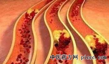健康之路20221116:刘新鹏,心脏的电路,房颤,心脏起搏器